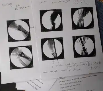 X-rays and notes