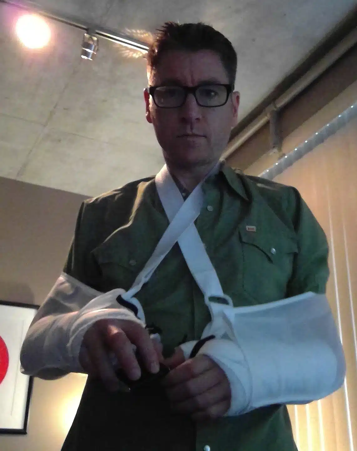photo of me with broken wrists