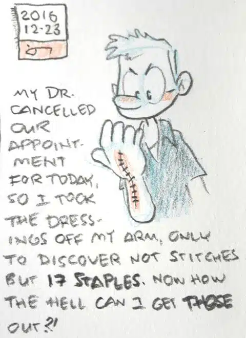 cartoon of me looking at stapled hand